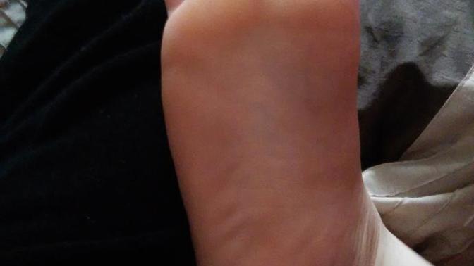What colour should the bottom of a person's foot be?