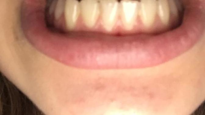 Why are my teeth so bad?