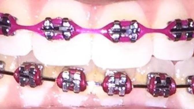 What do you think of my teeth?