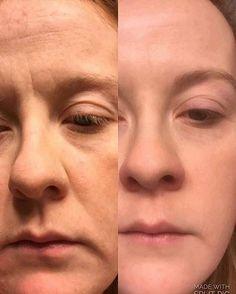 Girls, Getitng older and uglier?