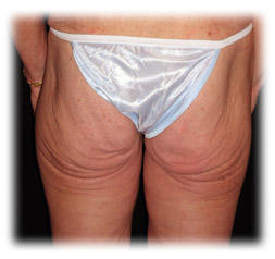 Girls, Getitng older and uglier?