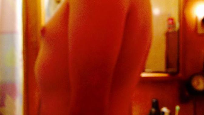 Is there anything I do about my posture? Can I use a posture brace to fix it? I have scoliosis if that matters?
