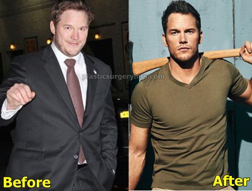 Does the face appear longer on losing face fat?