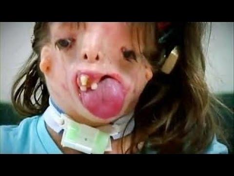 Will this girl be able to live a normal life?