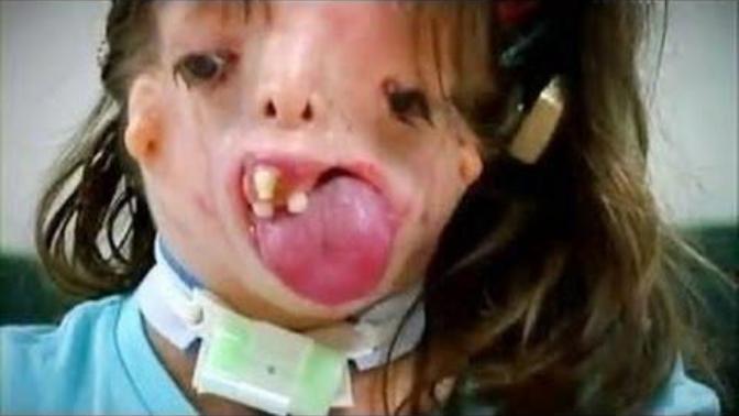 Will this girl be able to live a normal life?