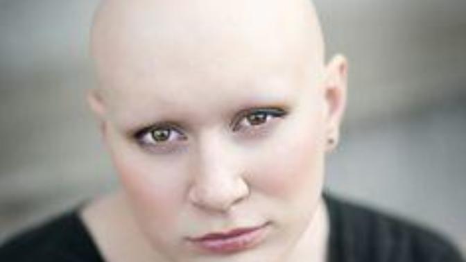 Would you date a bald woman with no eyebrows, no eyelashes, no body hair or no hair at all whatsoever?