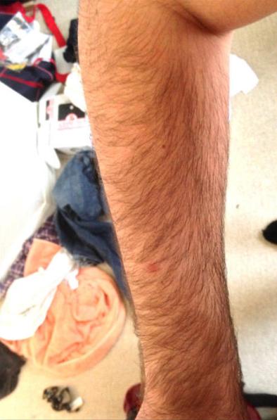 Girls, are hairy arms on guys a turn off?