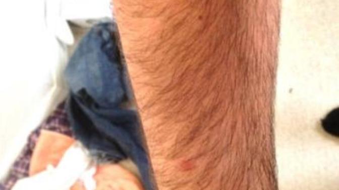 Girls, are hairy arms on guys a turn off?