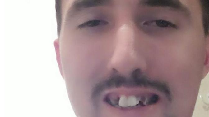 Girls, I've asked this before, but didn't include pics: how bad are my teeth in appearance and should I avoid smiling?