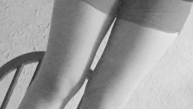 Do my legs look unattractive?