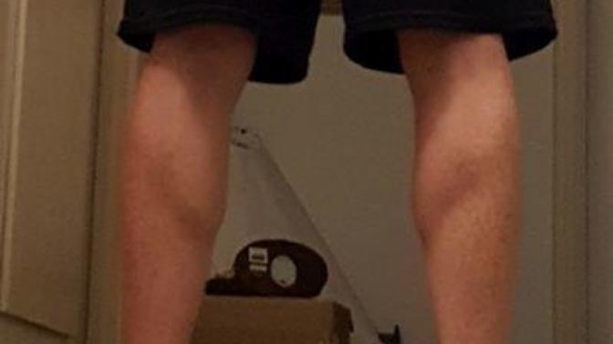 Looking at this pic, do my calves seem like they have much potential for growth?