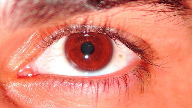 Do your eyes change color?