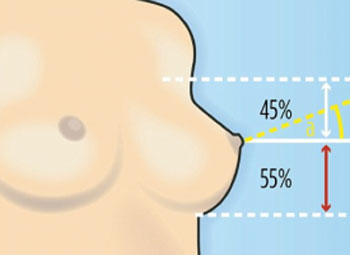 Girls, do you think you have the ideal breast shape?