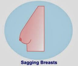 Girls, do you think you have the ideal breast shape?