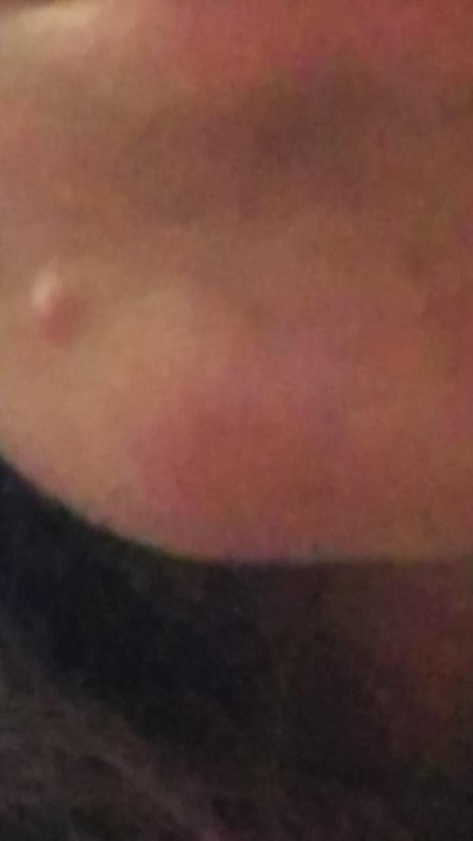 What is this on my face? And how to get rid of it?