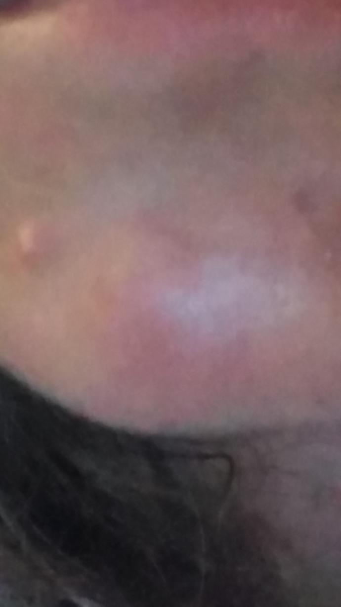 What is this on my face? And how to get rid of it?