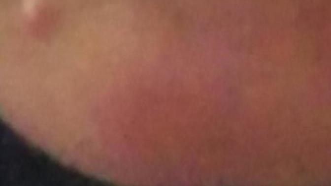 What is this on my face? And how to get rid of it?