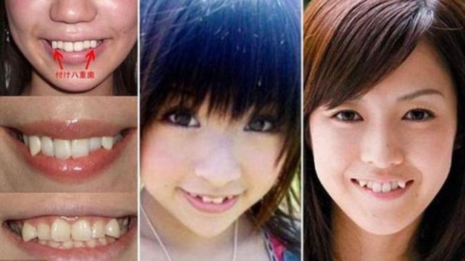 Can sharp canine teeth look hot?