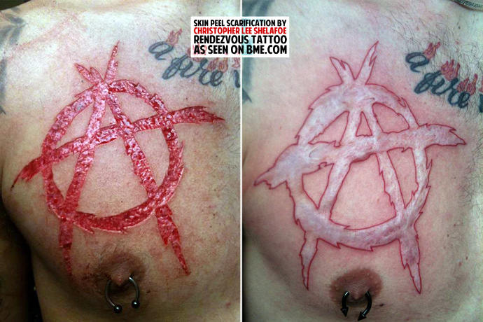 Weird trend : scar "tattoos" ?