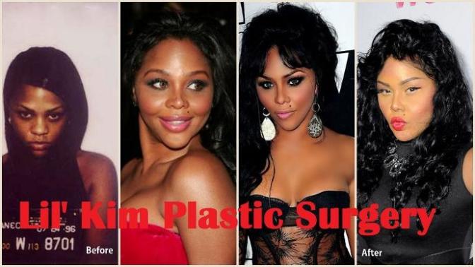 Which Lil' Kim picture looks the best?