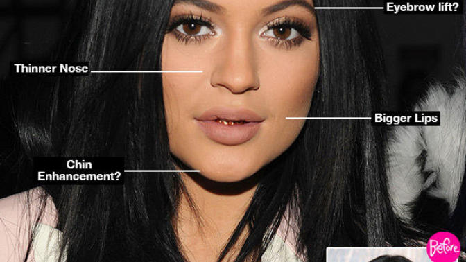 Do you think Kylie Jenner is pretty? Considering all of the plastic surgery?