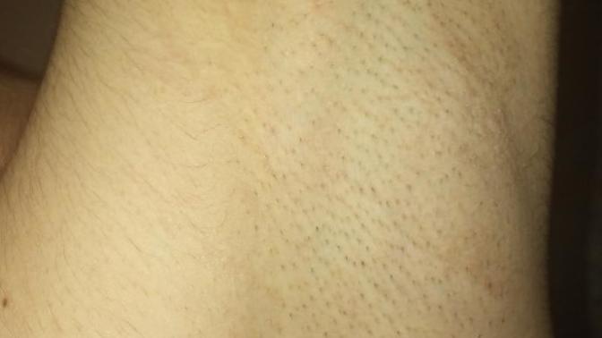 Girls, how does my underarm look?