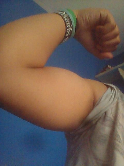 Do I have a short or a long muscle belly?