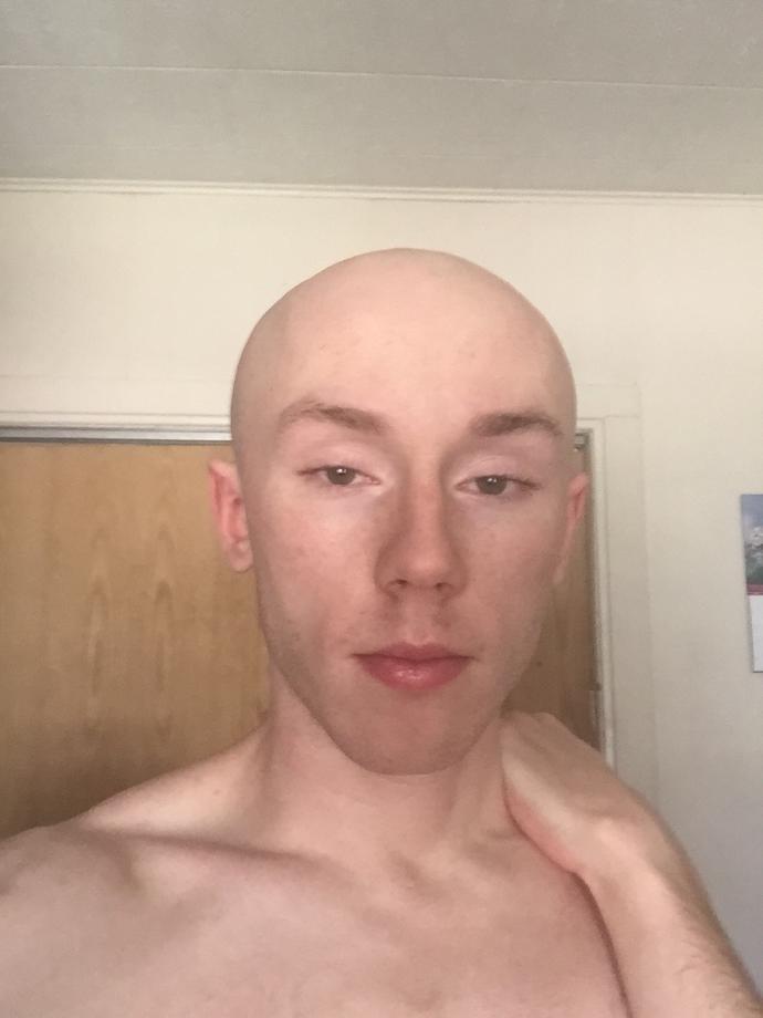 Girls, Around my age (29 tops please) do I pull off bald?