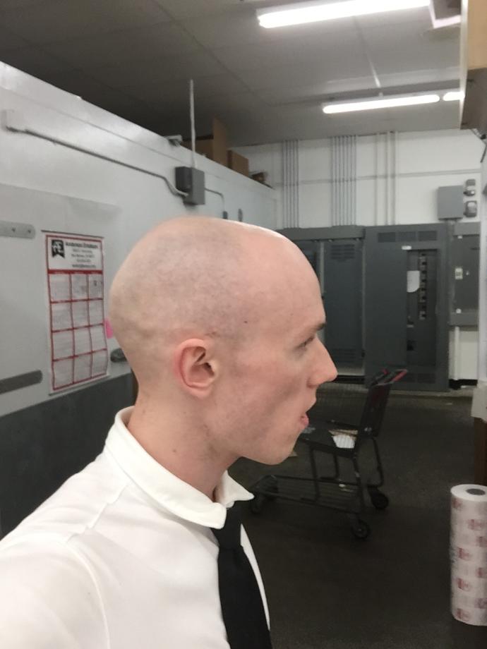 Girls, Around my age (29 tops please) do I pull off bald?