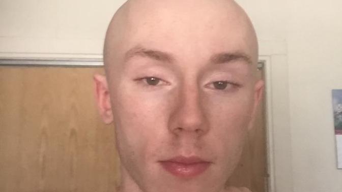 Girls, Around my age (29 tops please) do I pull off bald?
