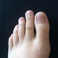 What type of feet do you have?