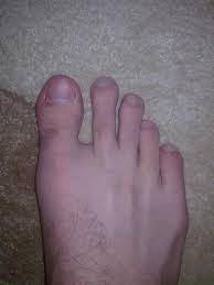 What type of feet do you have?