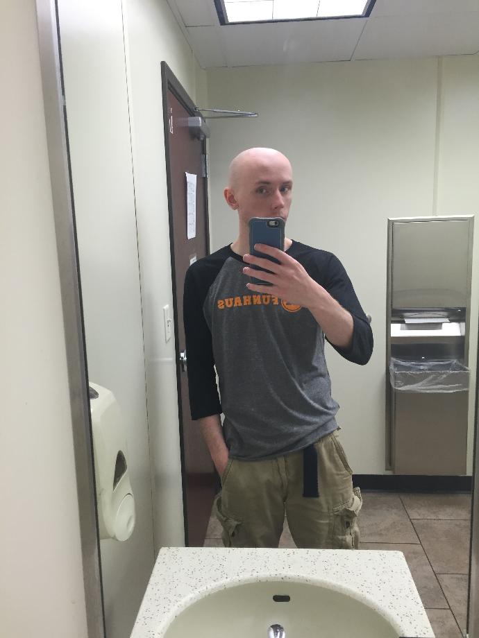 Girls, could you date a guy with this condition or is it a no-go for you (based only on looks here)?