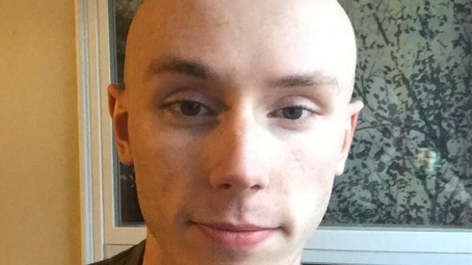 Girls, could you date a guy with this condition or is it a no-go for you (based only on looks here)?