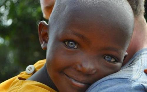 Black people with blue eyes, what are/would be your reaction seeing a black person with blue eyes?