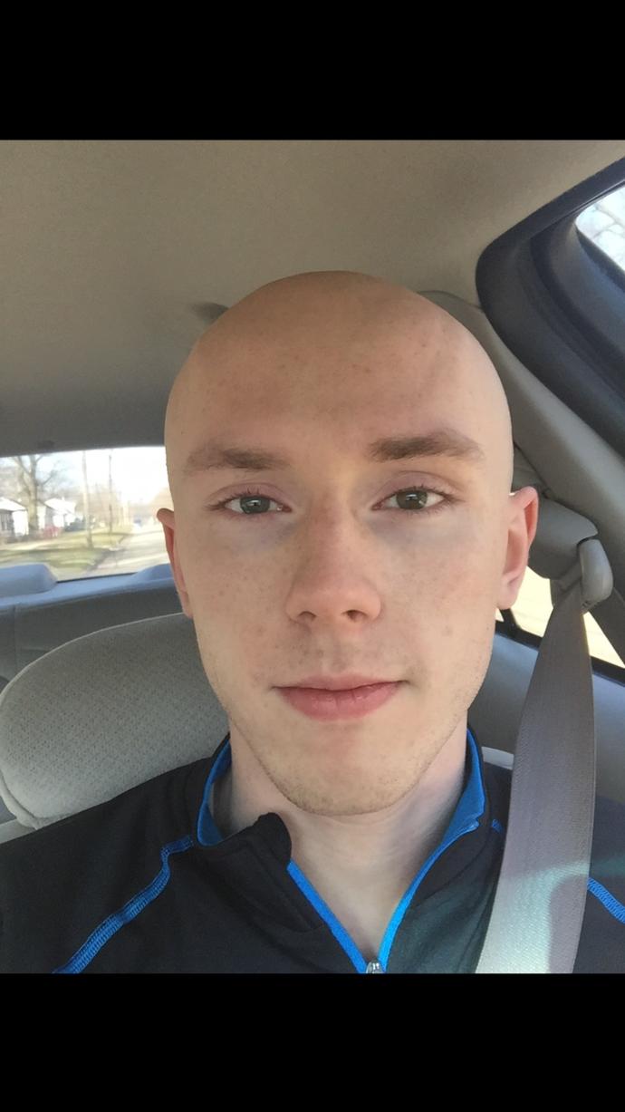 Girls, 18-24 Do I pull off shaved? It's my only real option now so be honest? Or is hair important to you?