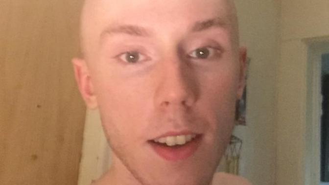 Girls, 18-24 Do I pull off shaved? It's my only real option now so be honest? Or is hair important to you?