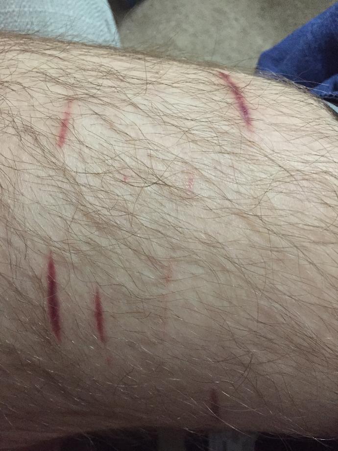 *Graphic* Will These Scars Ever Heal?