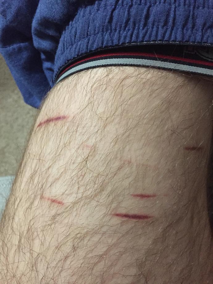 *Graphic* Will These Scars Ever Heal?