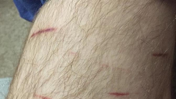 *Graphic* Will These Scars Ever Heal?
