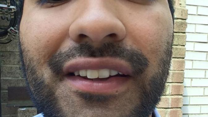 Of my two front teeth, would you say one is bigger than the other?