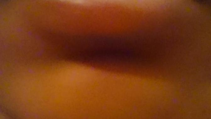 Do you get white lips from salt and vinegar crisps/chips?