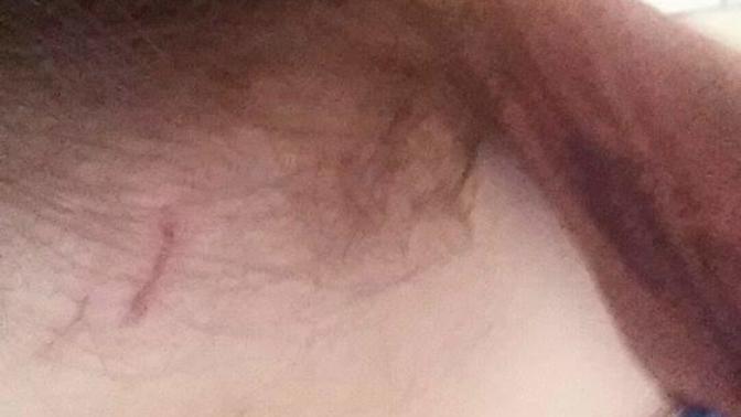 I was assaulted by my boyfriend's sister and now we don't know what to do?