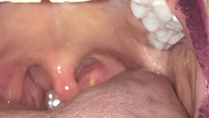 What is this in my mouth?