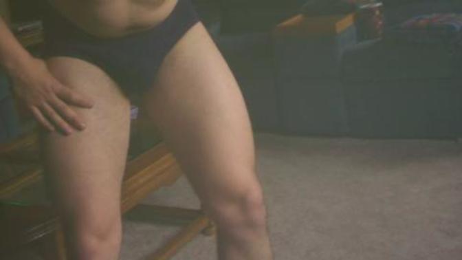 Do I look okey to wear speedo to go swimming with legs like this?