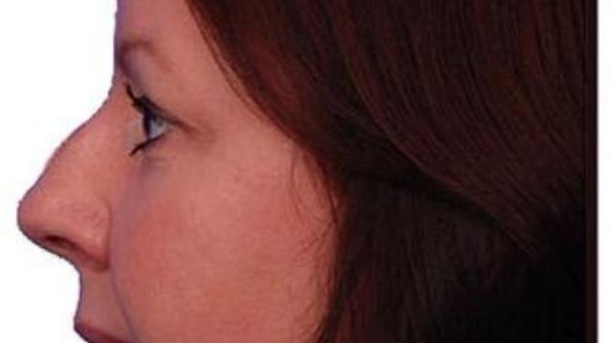 Guys, how much girls (big/ugly) nose is turn off for you?