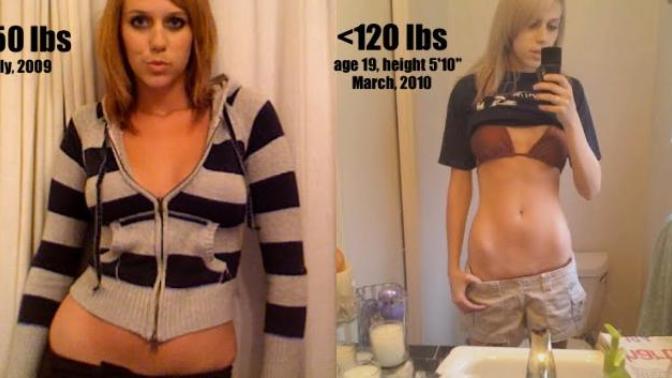 What are signs you're developing anorexia?