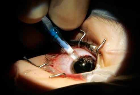 What's the best solution for bad eyesight?