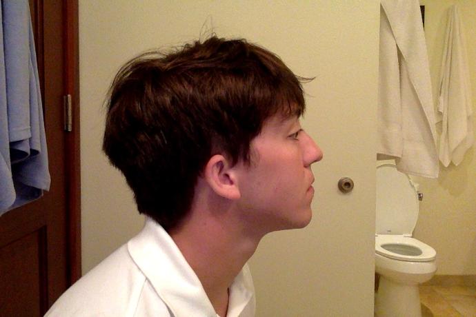 I worry about my weak chin and jawline (it's off center too). Please (honestly) rate the attractiveness of my face 1-10?