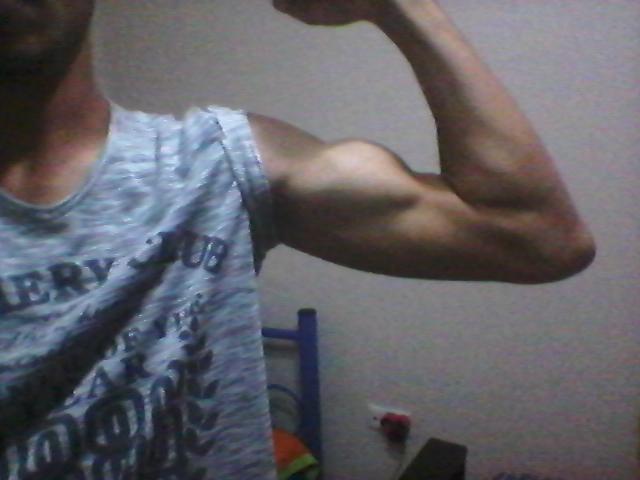 My arm is pretty ?